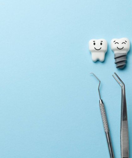 Kto wynalazł implanty dentystyczne?
